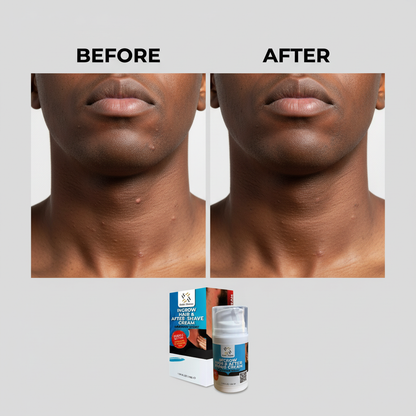 Ingrow Hair & After Shave Cream - Black Model Neck Before and After