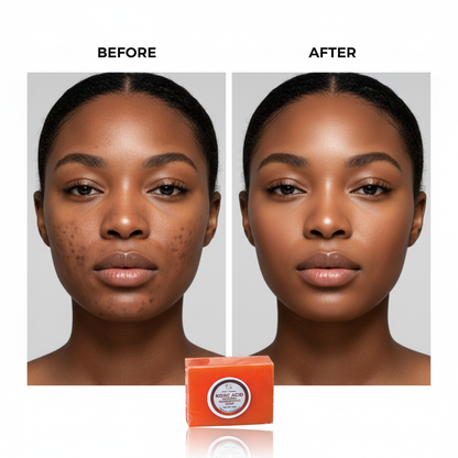 Kojic Acid Soap Before and After - Black Female